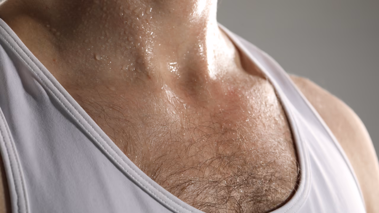 Zweetdruppels op huid: typisch beeld bij hyperhidrosis of overmatig zweten