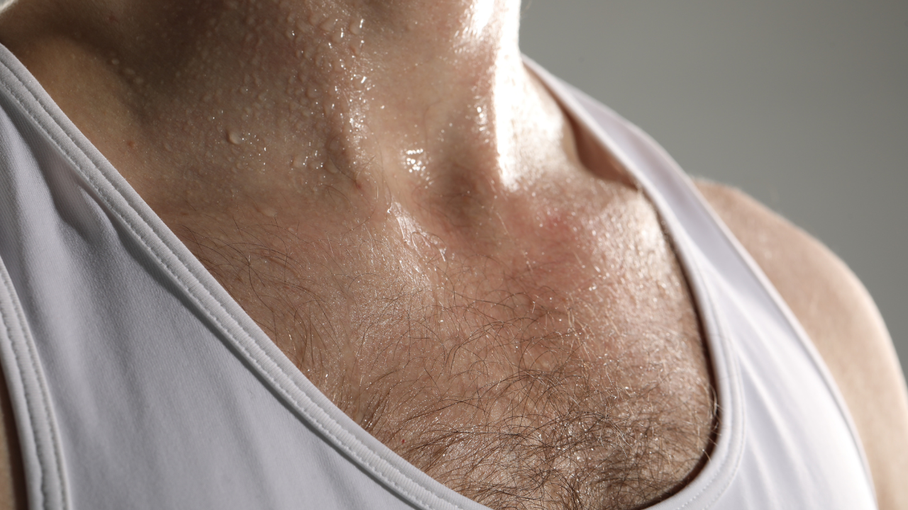 Zweetdruppels op huid: typisch beeld bij hyperhidrosis of overmatig zweten