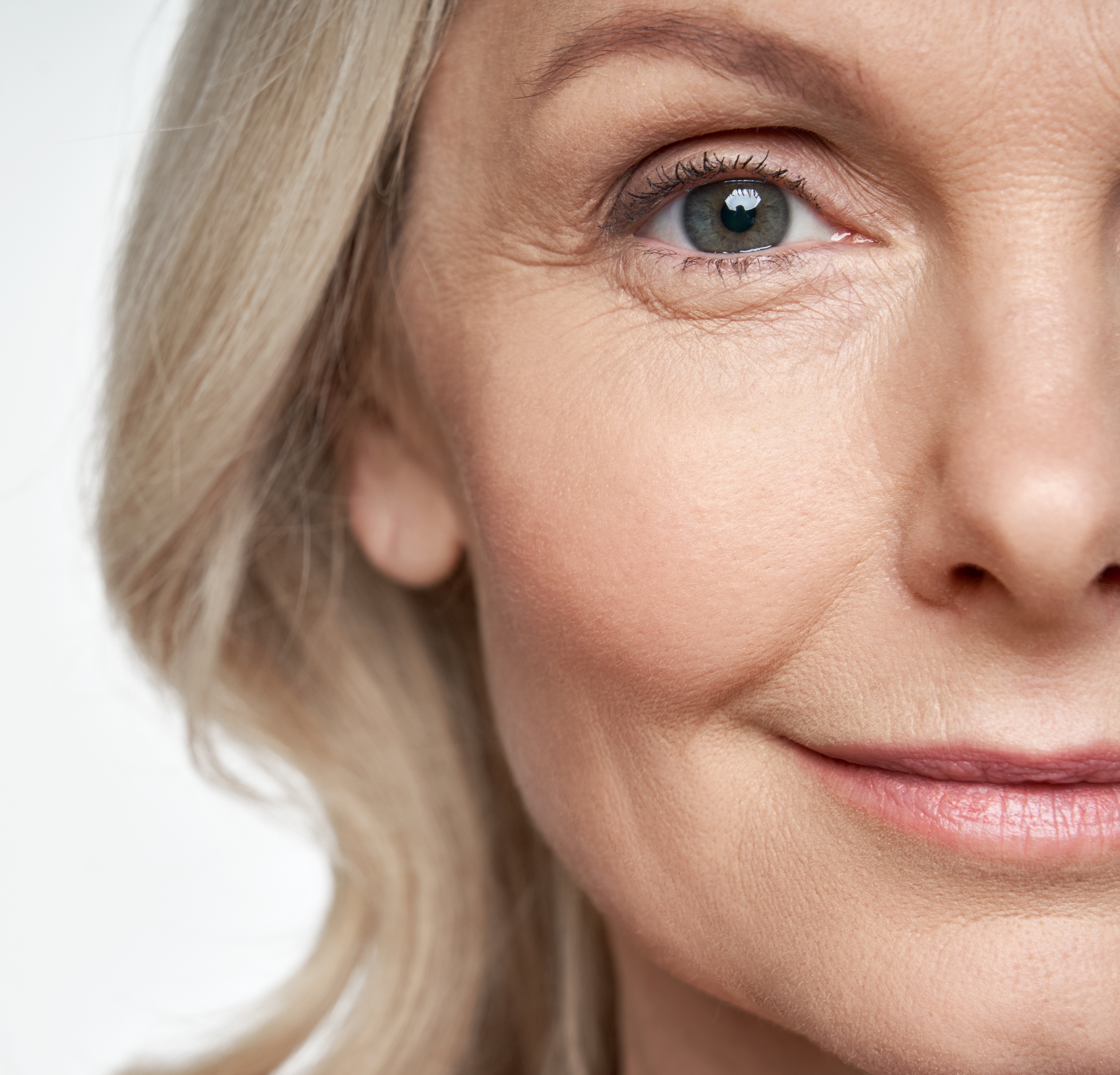 Medisinsk behandling av linjer og rynker