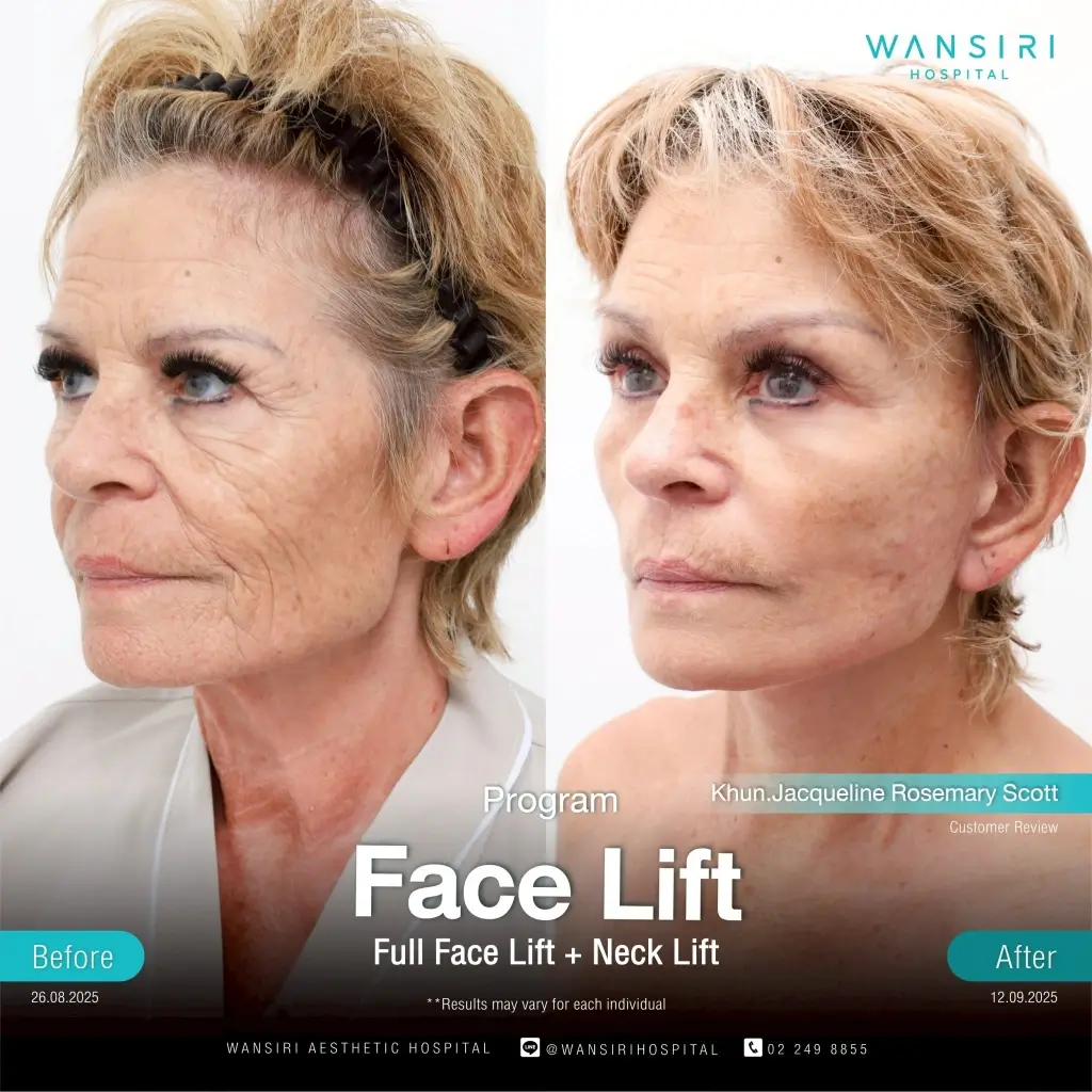 Before-after 5 (Wansiri Hospital)