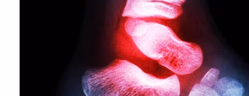 ankle pain in muscle