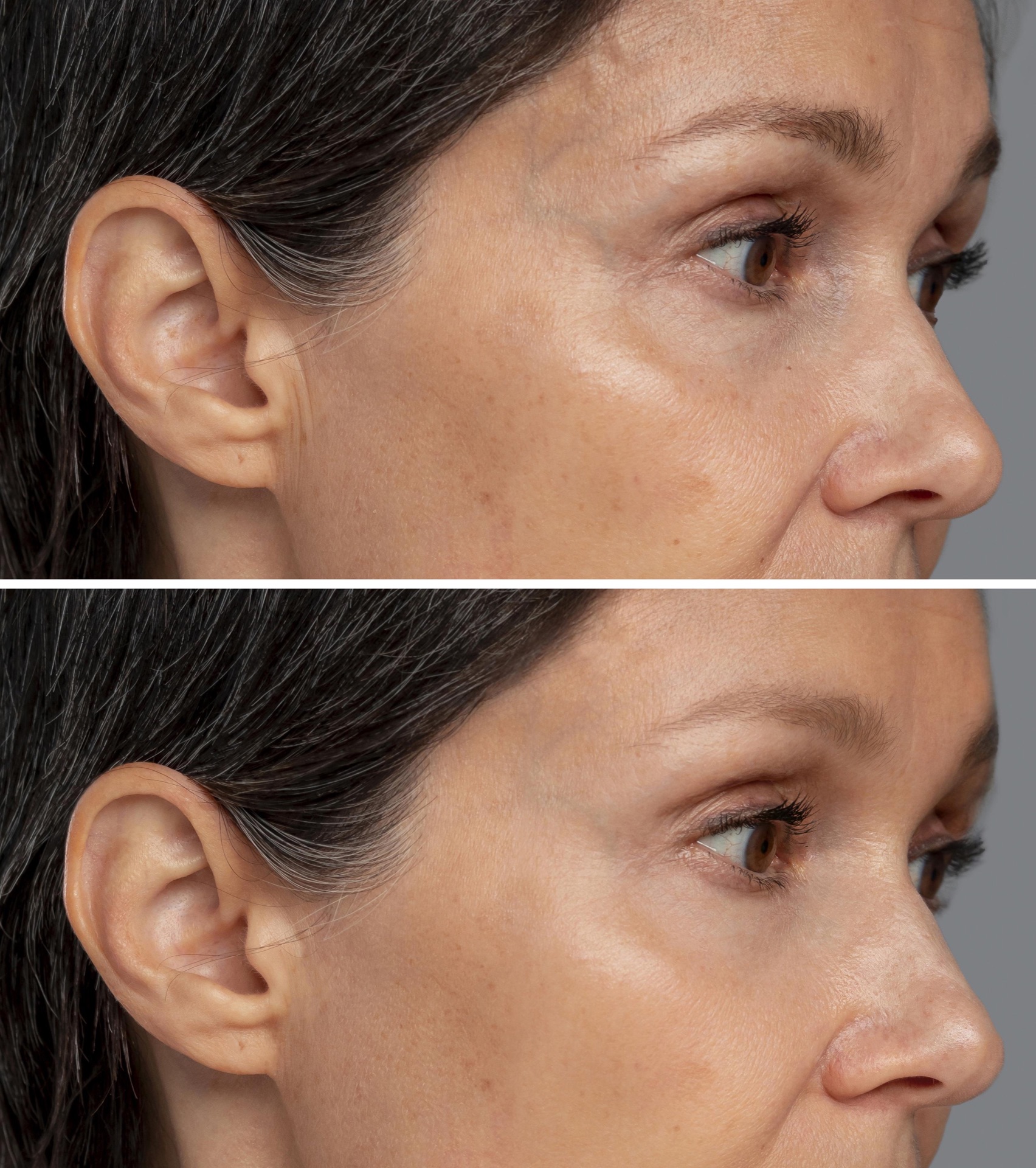 Dark spots on the skin 