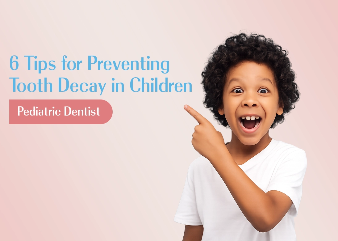 6 Tips for Preventing Tooth Decay in Children | Pediatric Dentist