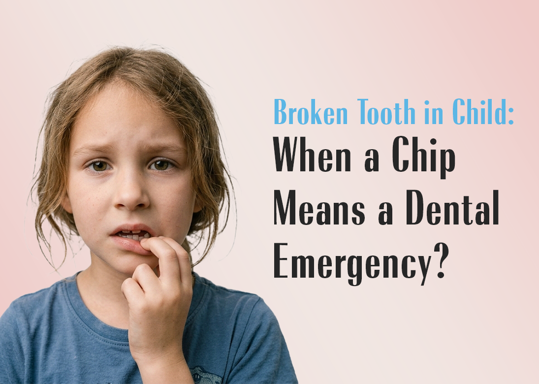 Broken Tooth in Child: When a Chip Means a Dental Emergency?