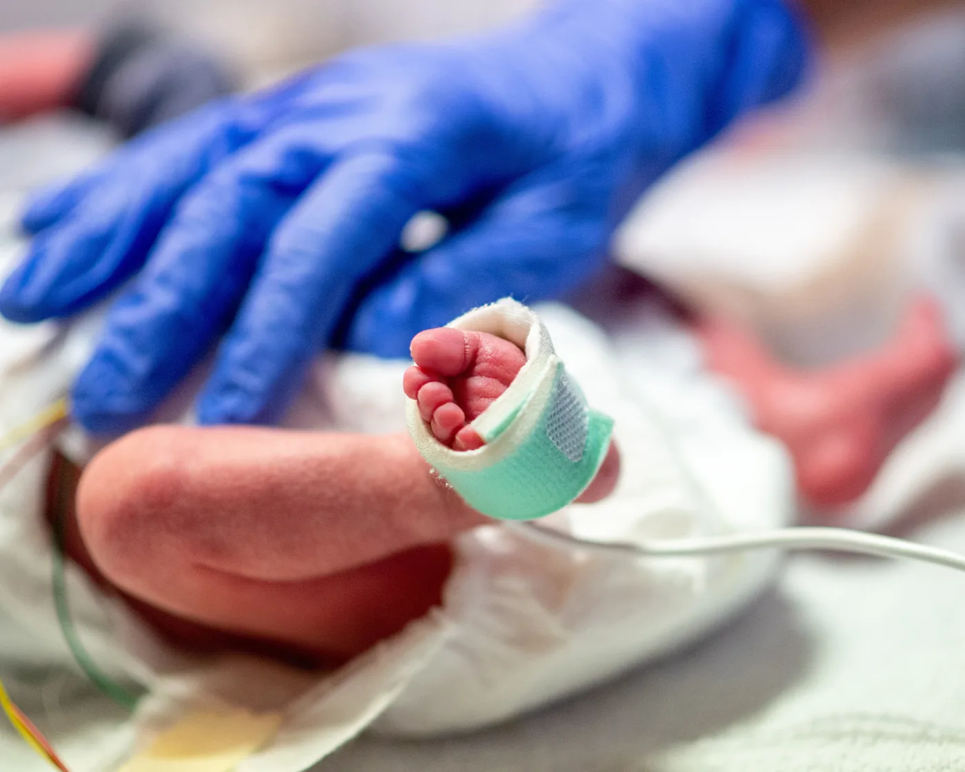 Frühgeborenes mit Pulsoximeter am Fuß auf der neonatologischen Intensivstation