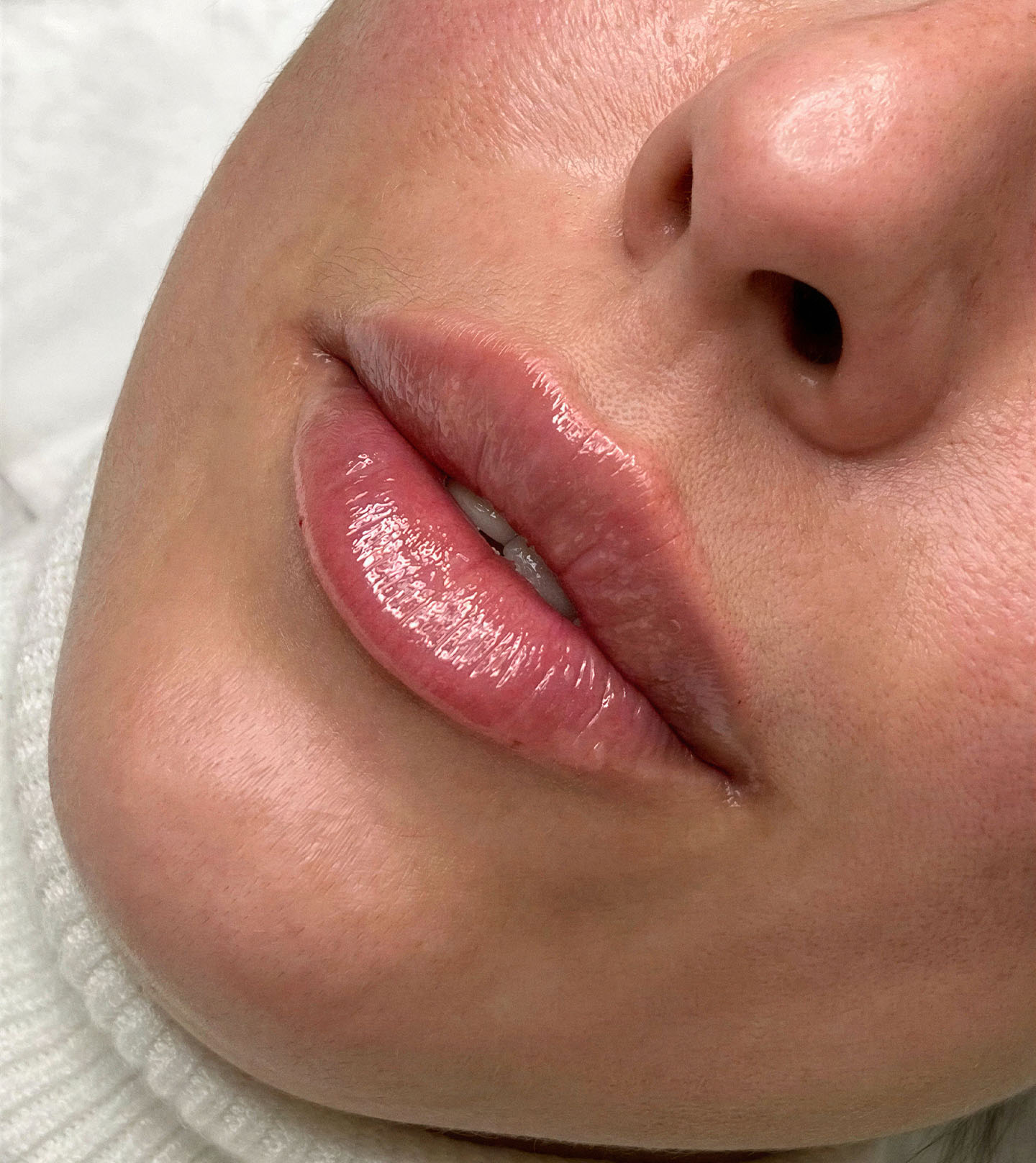 Lip Blush 5