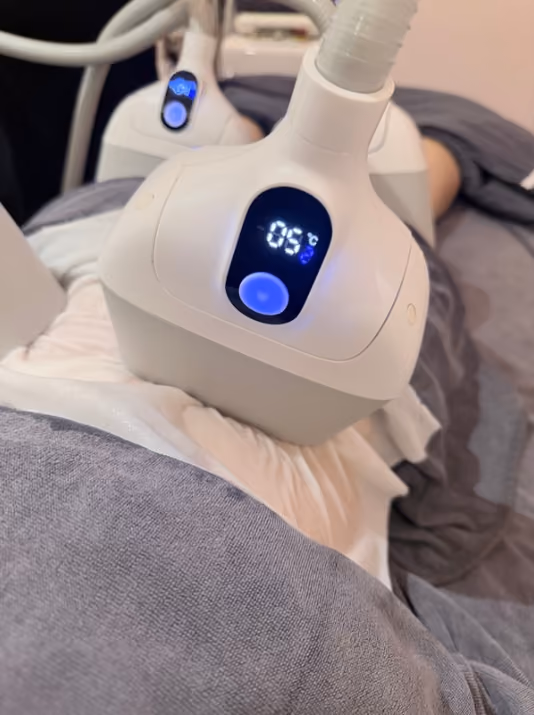 Fat Freeze treatment at Kosme Aesthetics Singapore