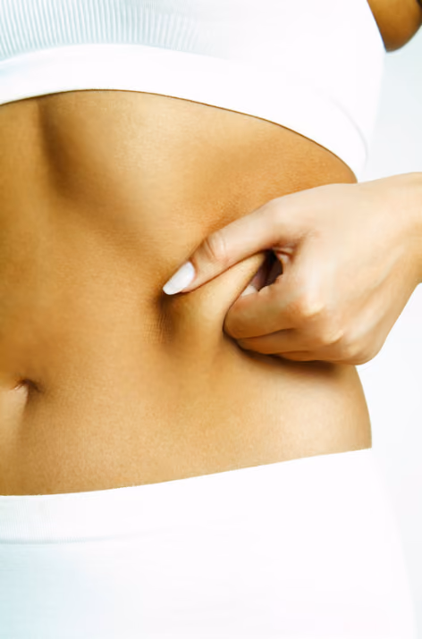 Fat Freeze treatment at Kosme Aesthetics