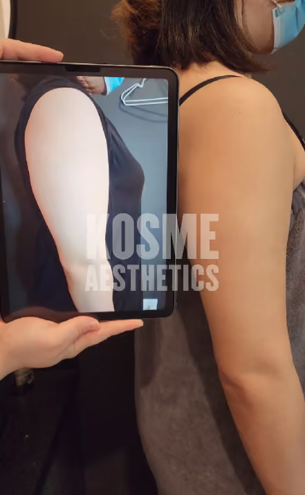 EmShape before and after result 2