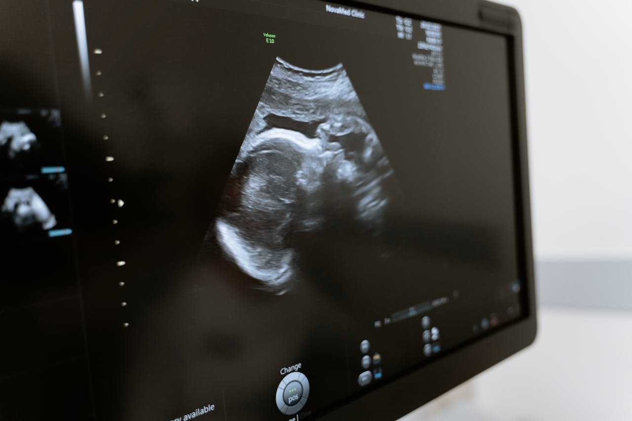 Photo Of Ultrasound Testing