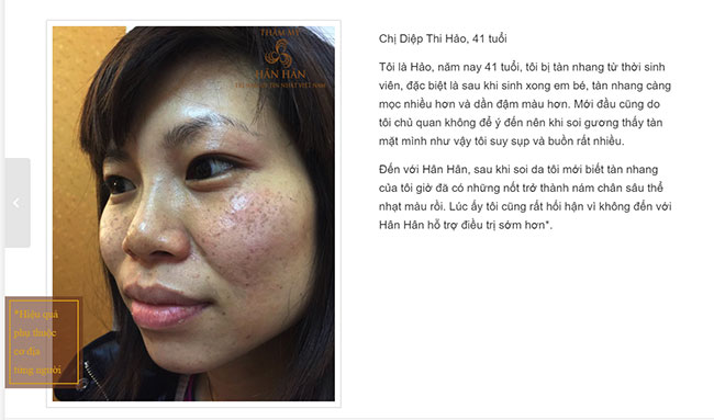 spa trị nám
