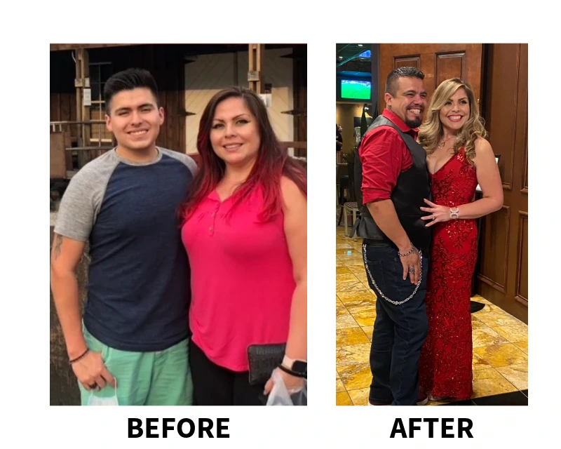Liz's Bariatric Surgery Success Story