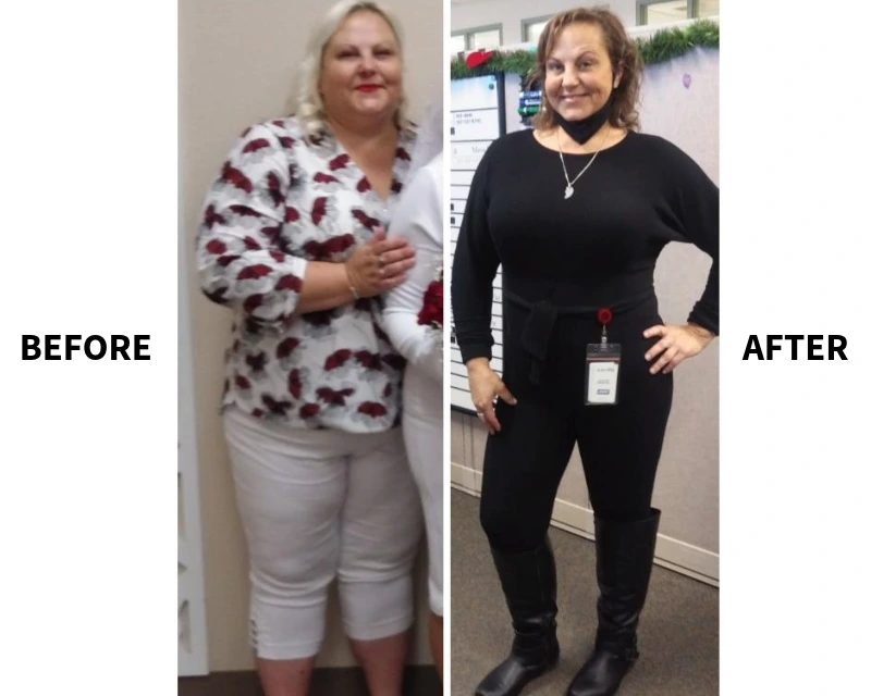 Gastric Sleeve Surgery Helps Patient Lose 120 Pounds and Kick Diabetes