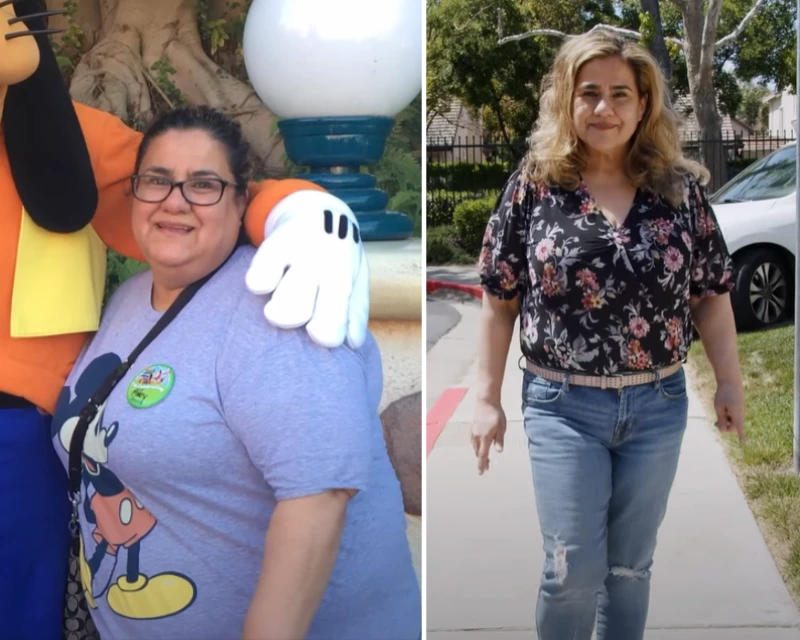 Before and after photos showing Gina’s bariatric transformation.