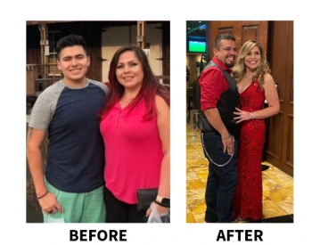 Before-and-after photos of Liz’s weight-loss surgery transformation.