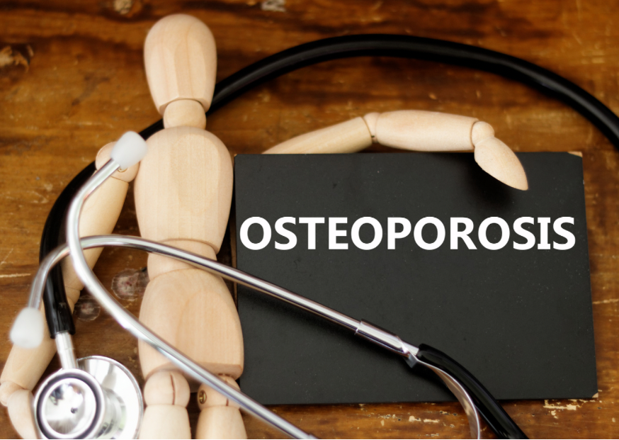Osteoporosis and Nutrition: Foods and Supplements for Stronger Bones