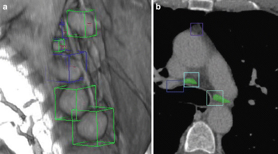 Figure 5: 3D object detection in medical images.