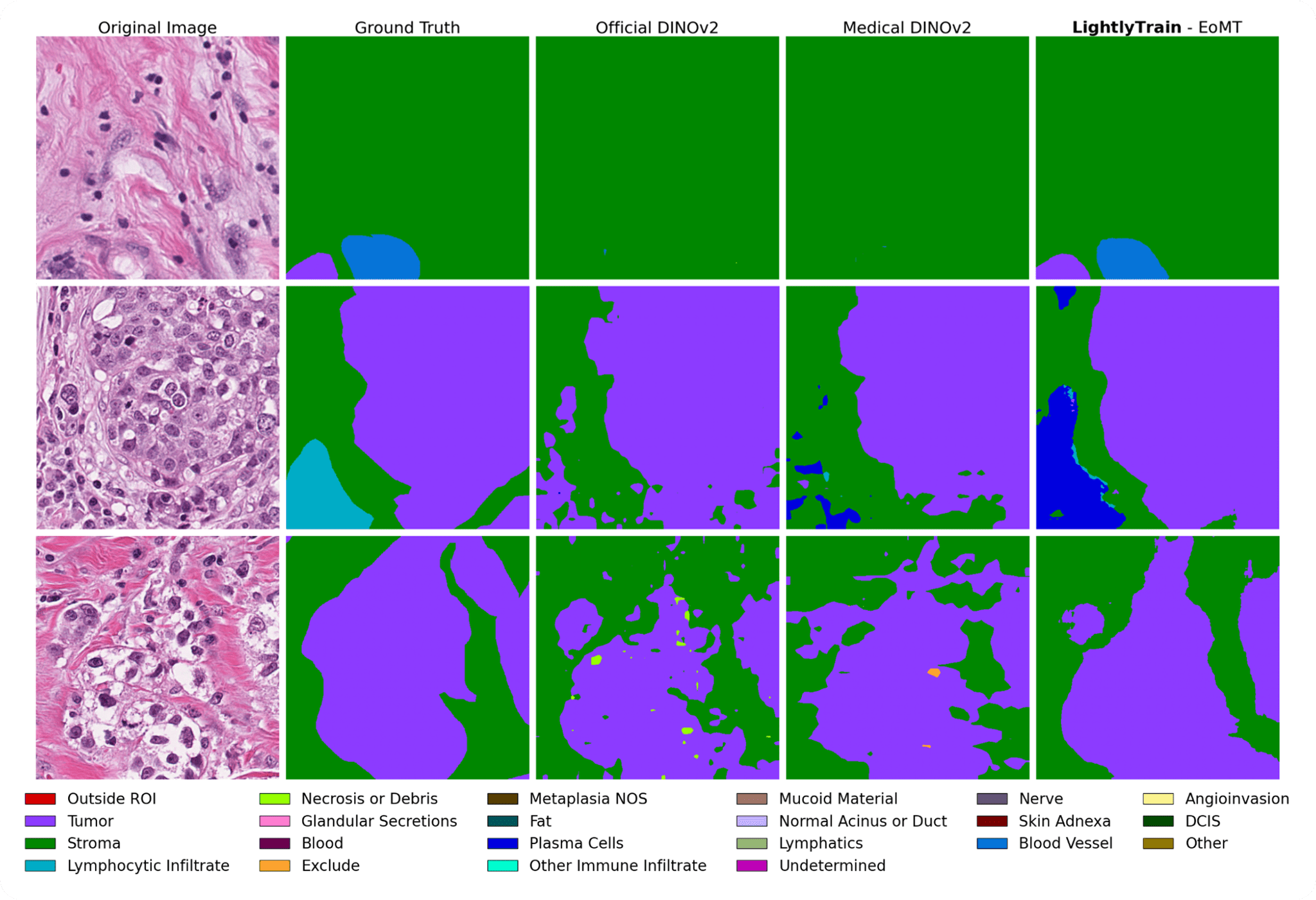 Figure 5. Qualitative comparison of predicted segmentation masks. The model trained with in-domain pre-training followed by fine-tuning produces the most accurate and visually consistent results, capturing tissue boundaries more faithfully than alternative approaches.