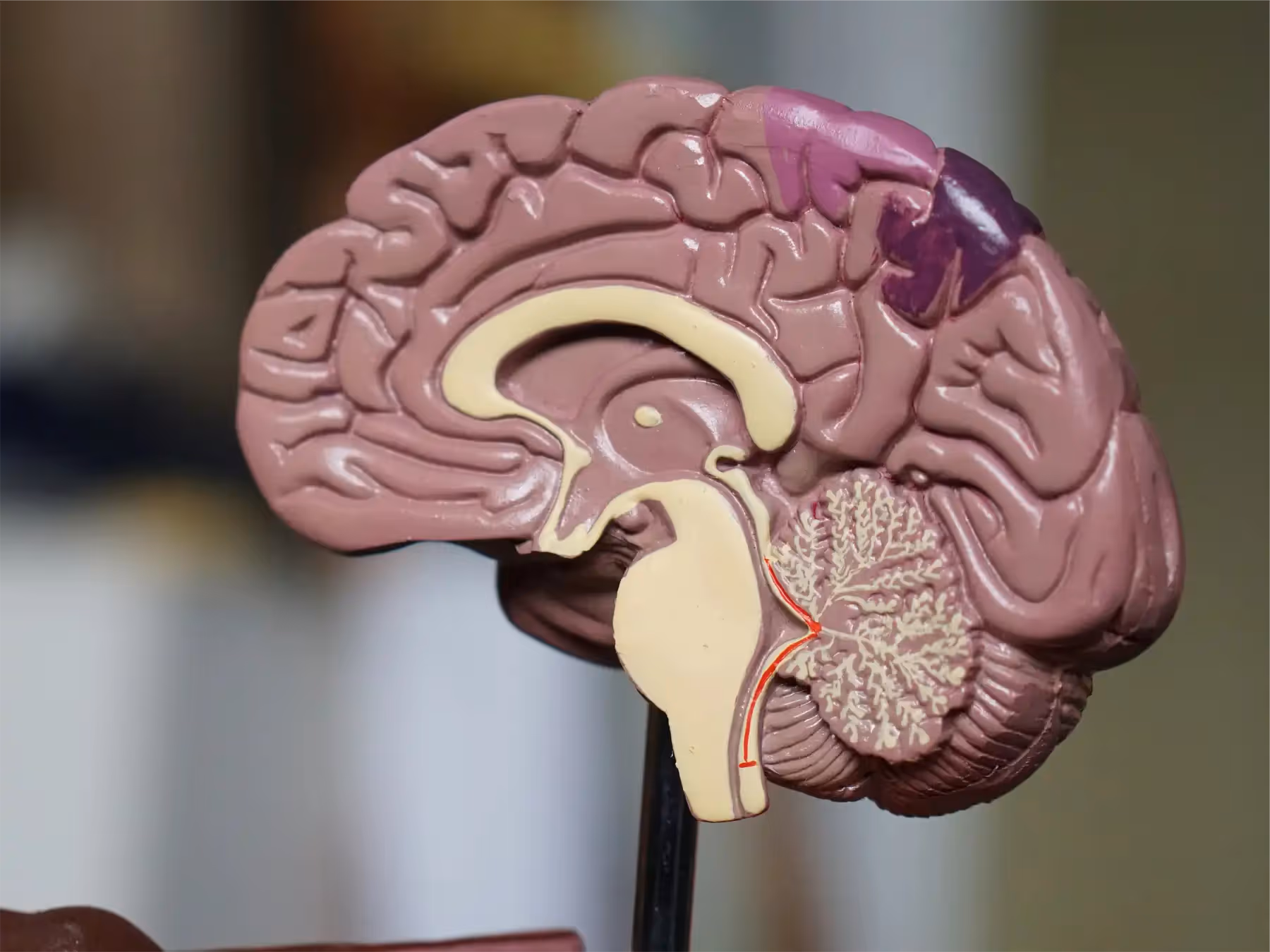 The Impact of Neurophysiological Biomarkers on Cognitive Function in Alzheimer's