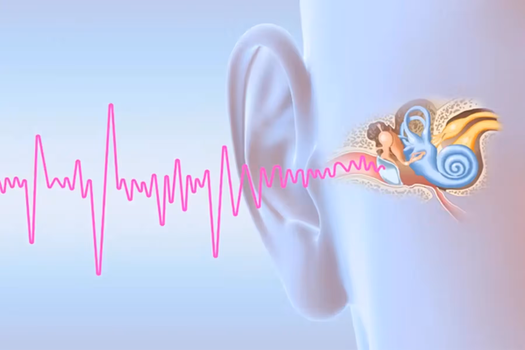 Neurofeedback for Tinnitus: What Does the Science Really Tell Us?