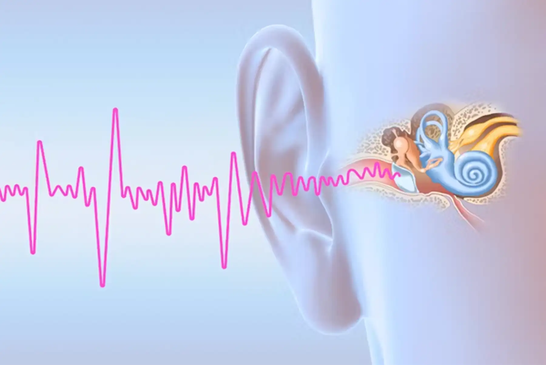 Neurofeedback for Tinnitus: What Does the Science Really Tell Us?