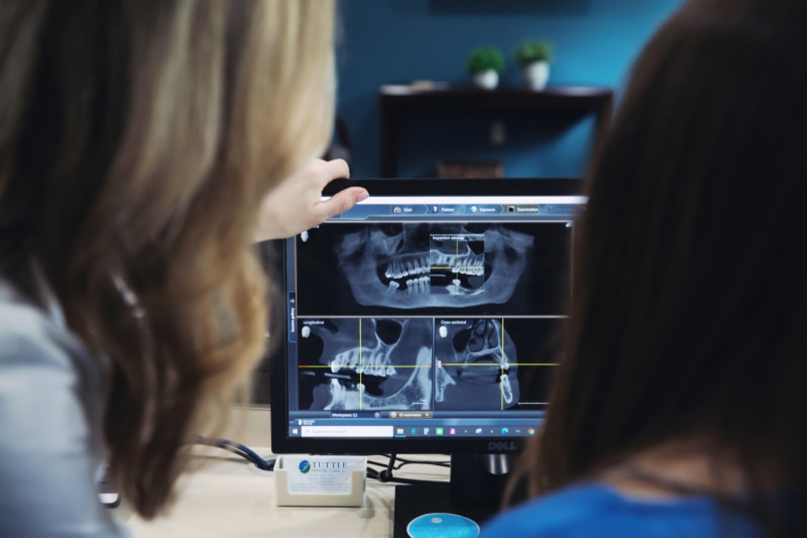 Two people viewing a 3D dental implant model on a computer screen during a consultation.