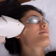 Person receiving a skincare or laser treatment on the face while wearing protective silver eye shields, held by a gloved hand using a white handheld device.