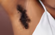 under arm hair
