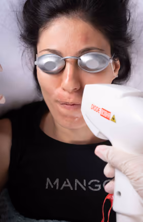 Close-up of a woman wearing protective goggles receiving laser treatment on her face with a diode laser device held by a gloved hand.