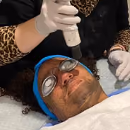 A person wearing protective eyewear and a blue headband receives a facial treatment with a handheld device operated by a technician wearing white gloves and a leopard print sleeve.