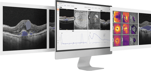 RetinAI | Intelligence in Ophthalmology