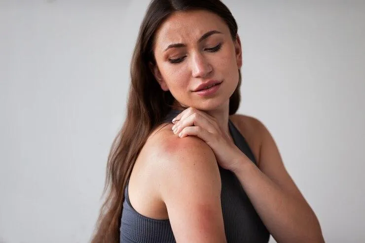 Une femme qui se gratte avec des traces rouges sur la peau