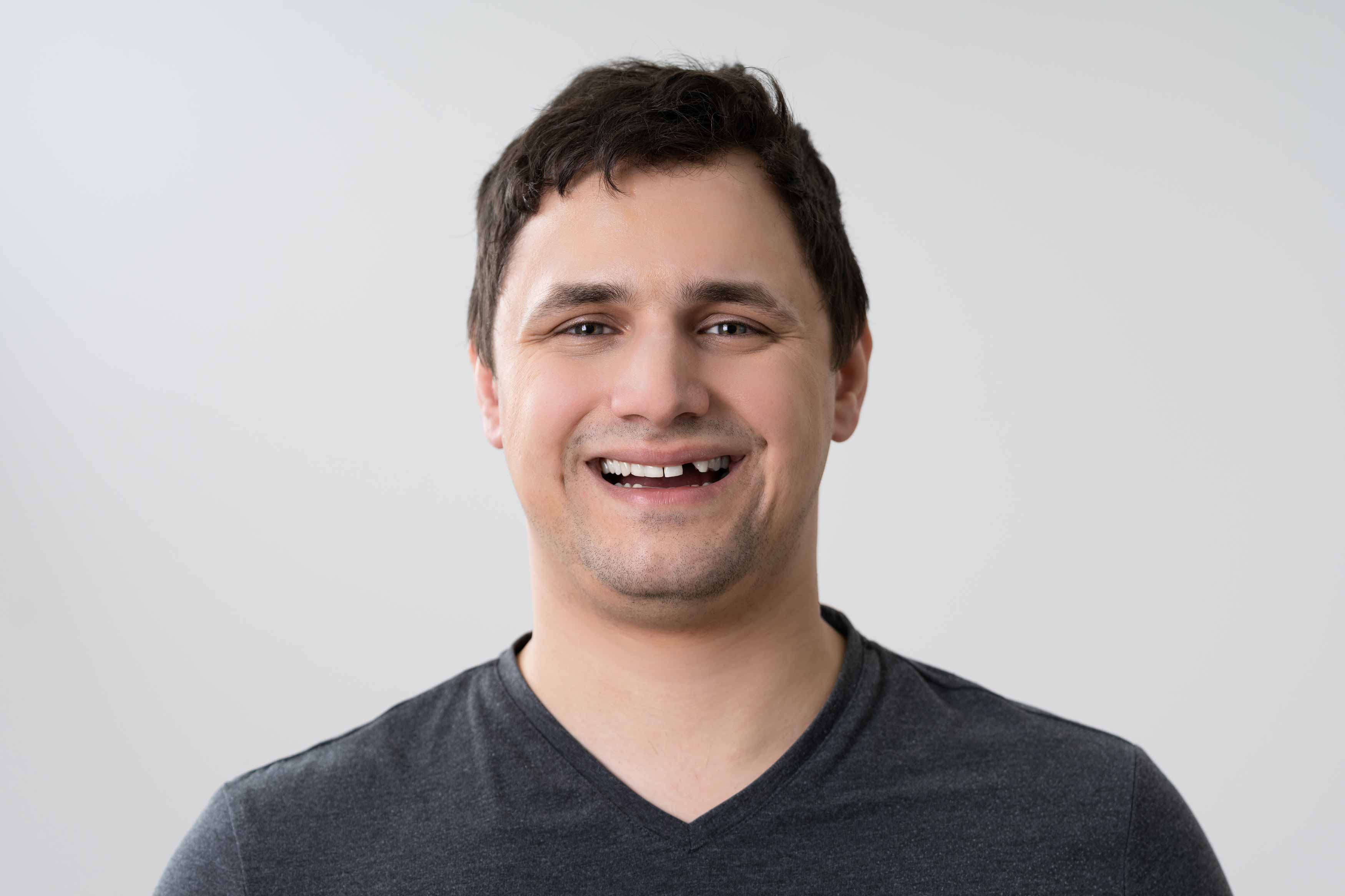 A photo of a young male smiling showing he has a missing front tooth 