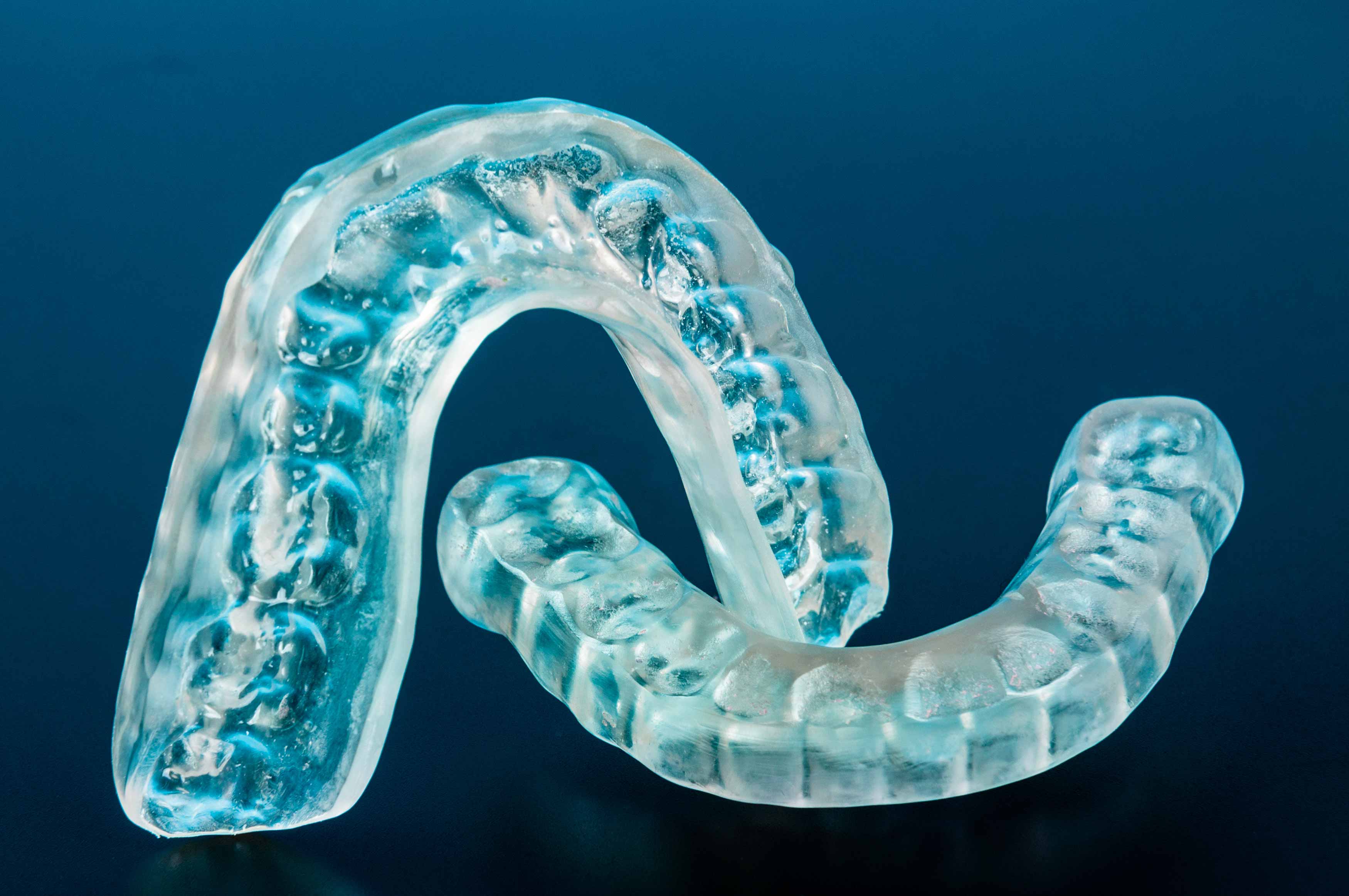 Photo showing an occlusal splint
