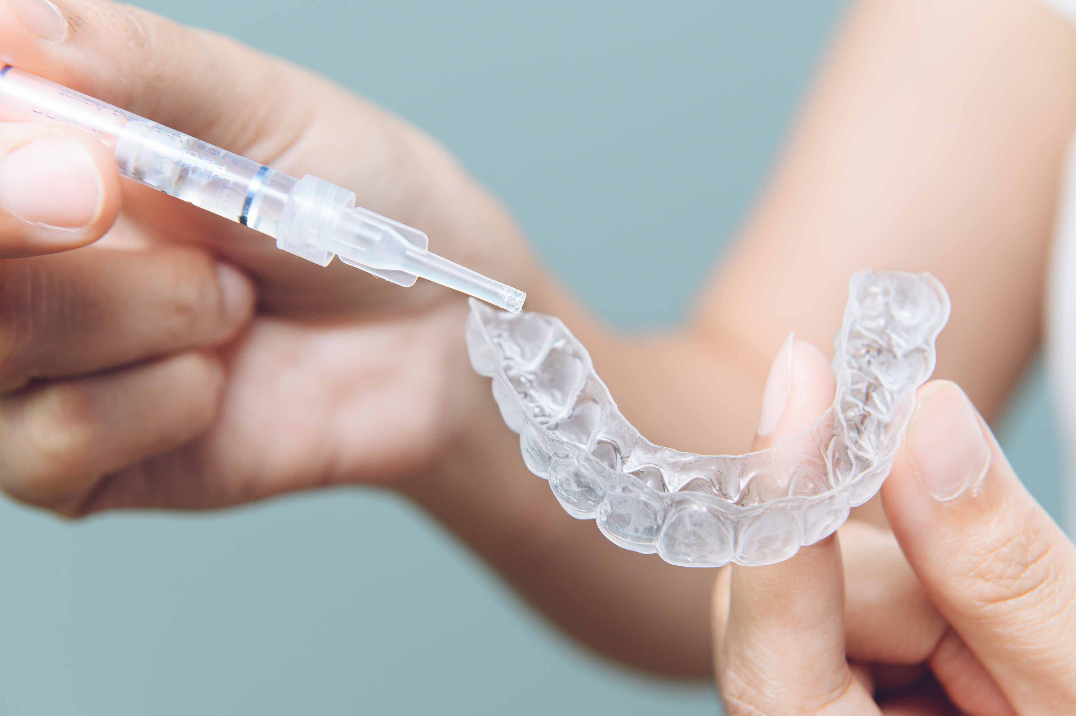 Photo of someone placing dental bleach into an upper dental bleaching tray