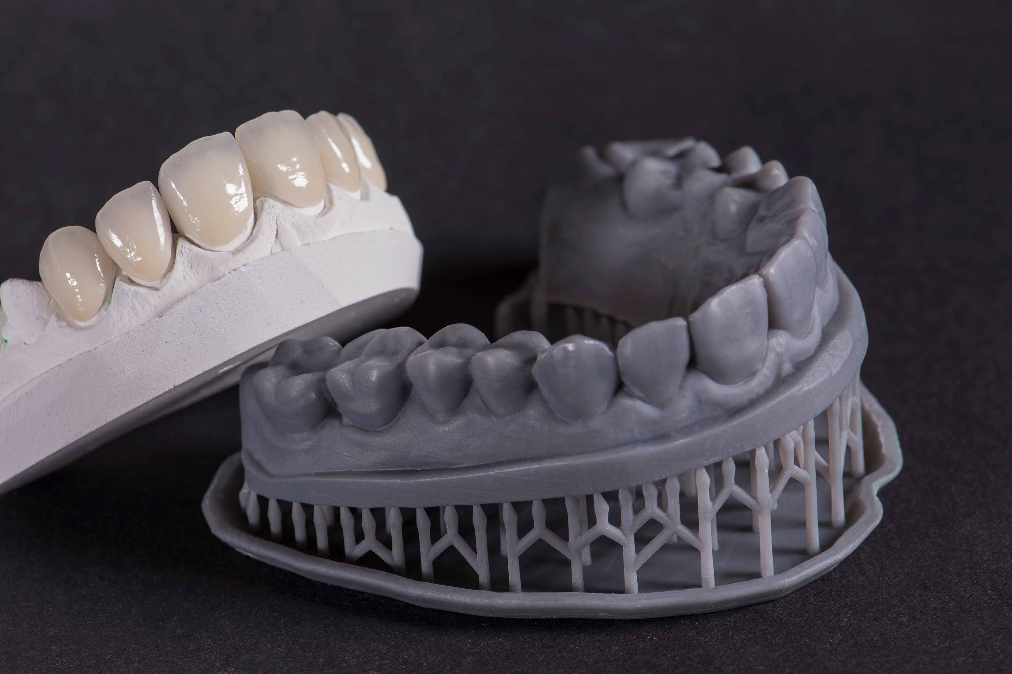 Photo showing multiple porcelain crowns alongside a 3D printed model 
