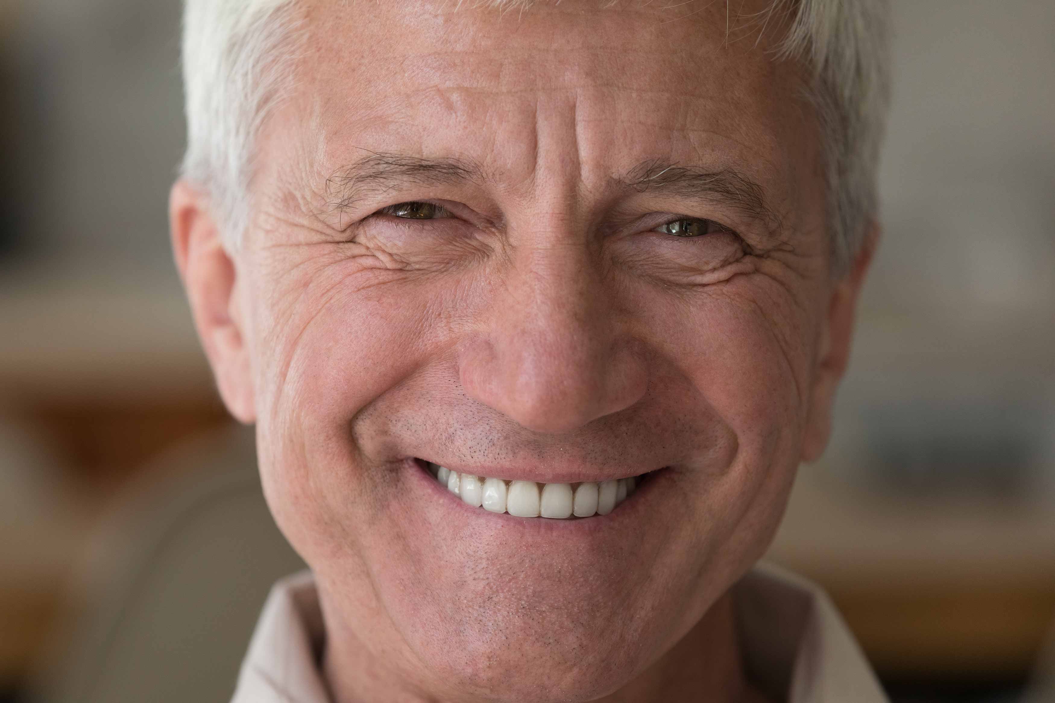 A photo of an elderly gentlemen smiling and showing off his teeth
