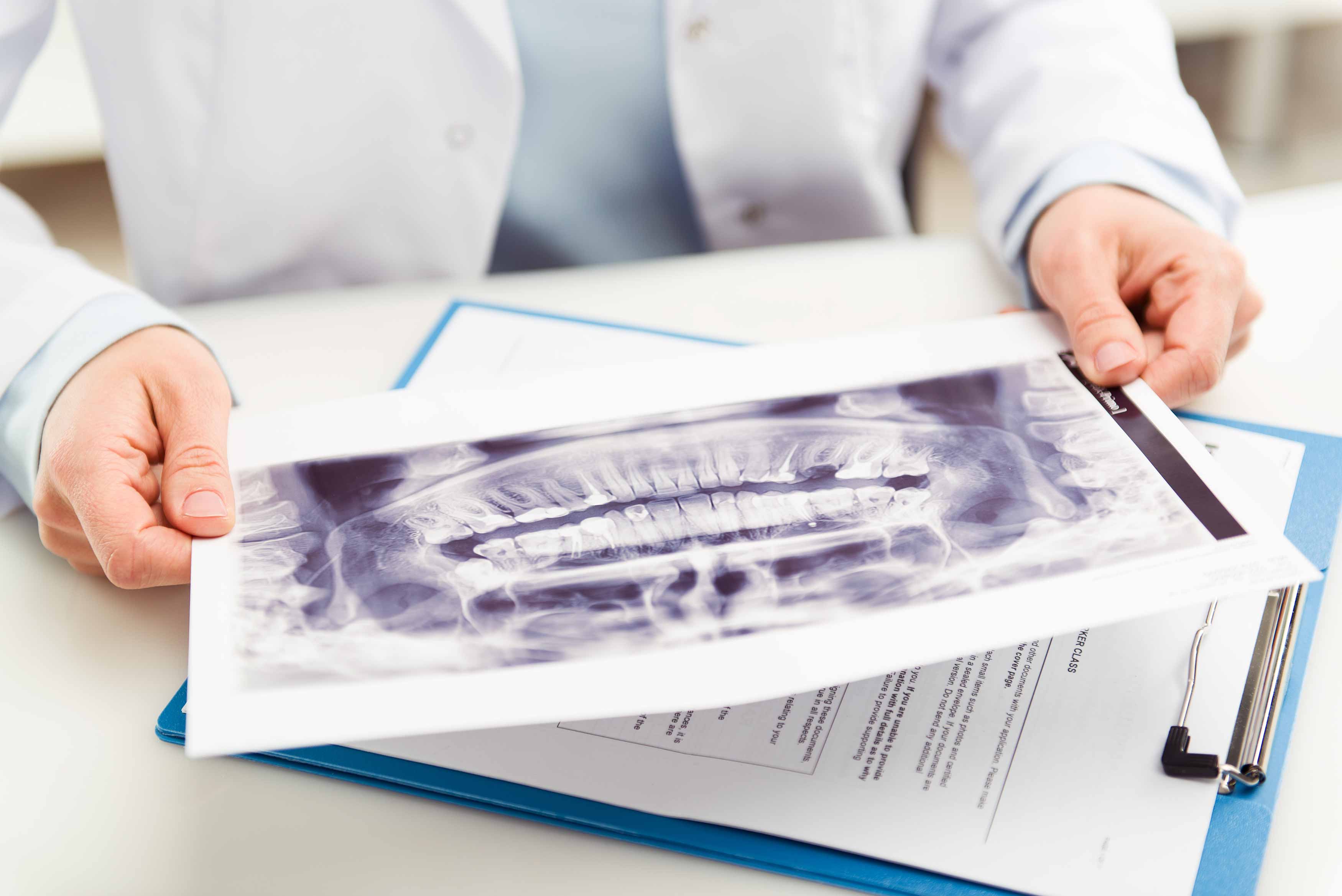 Photo of a dentist holding an OPG of a patient