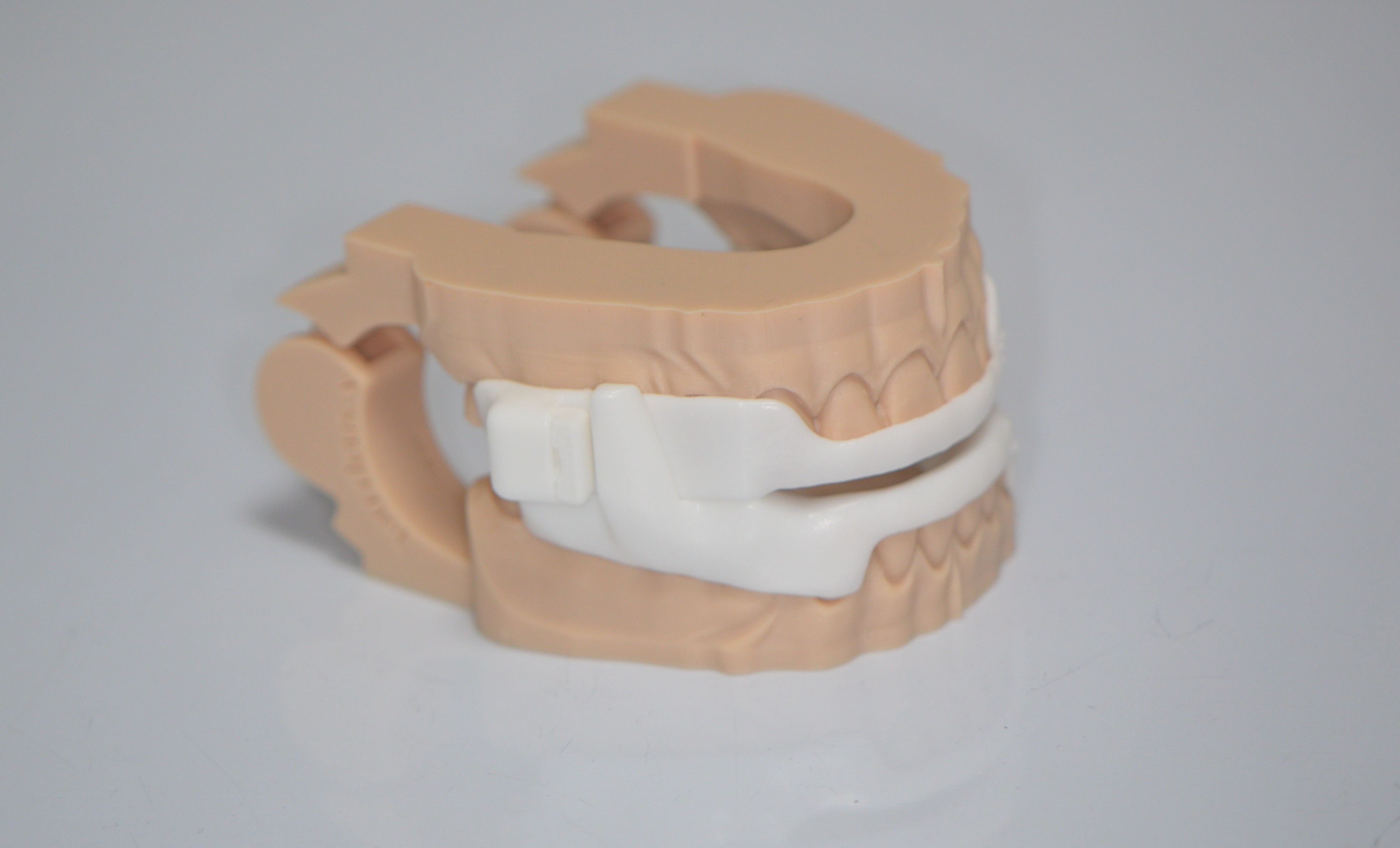 It is a photo of a mandibular advancement splint used for patients with sleep apnoea. 