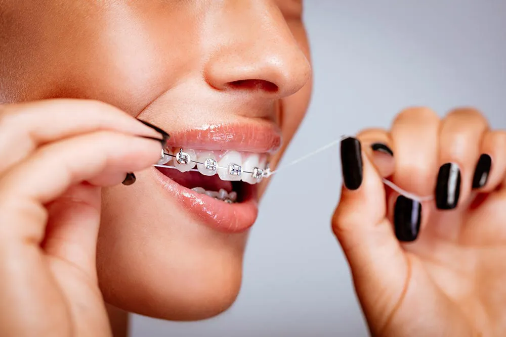Flossing with braces - Bettagere Orthodontics