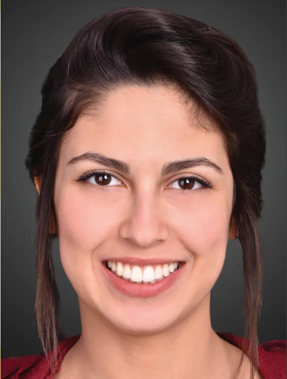 Smile arc protection illustrating proper tooth alignment