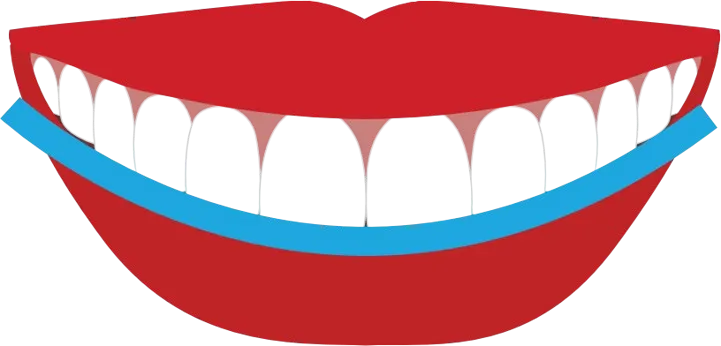 Orthodontic smile arc protection illustration