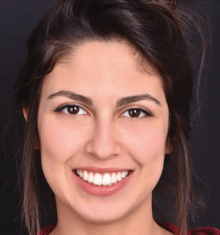 Smile Arc Protection