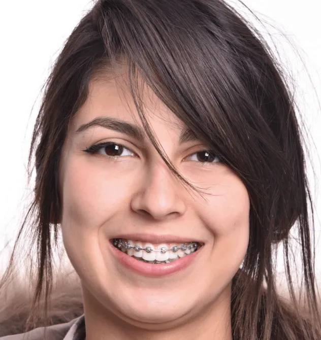 Orthodontic care focused on maintaining the smile arc