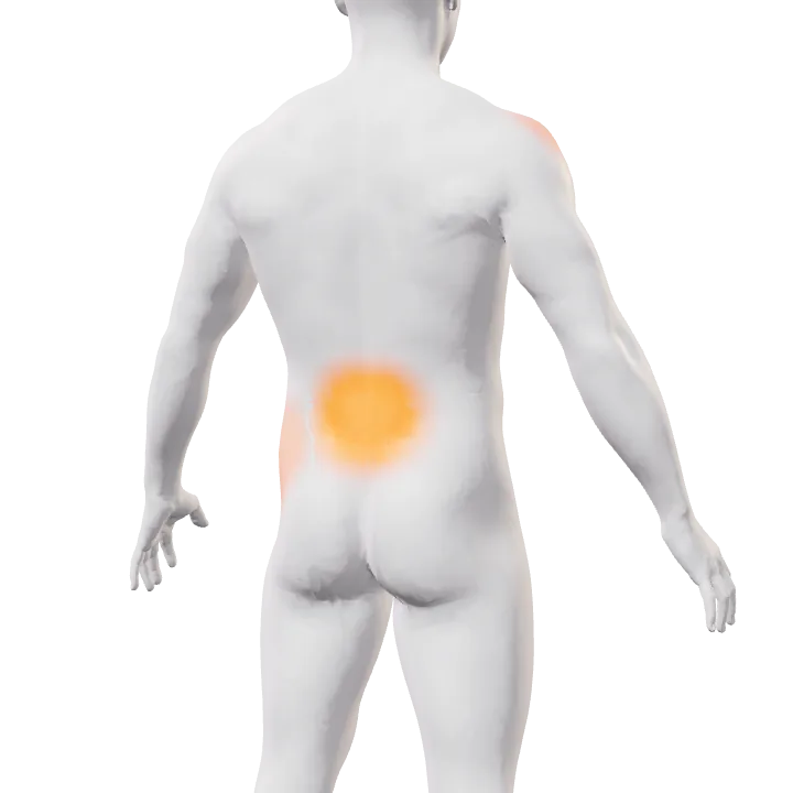 Espalda con la zona lumbar en naranja intenso y señales en hombro y cadera