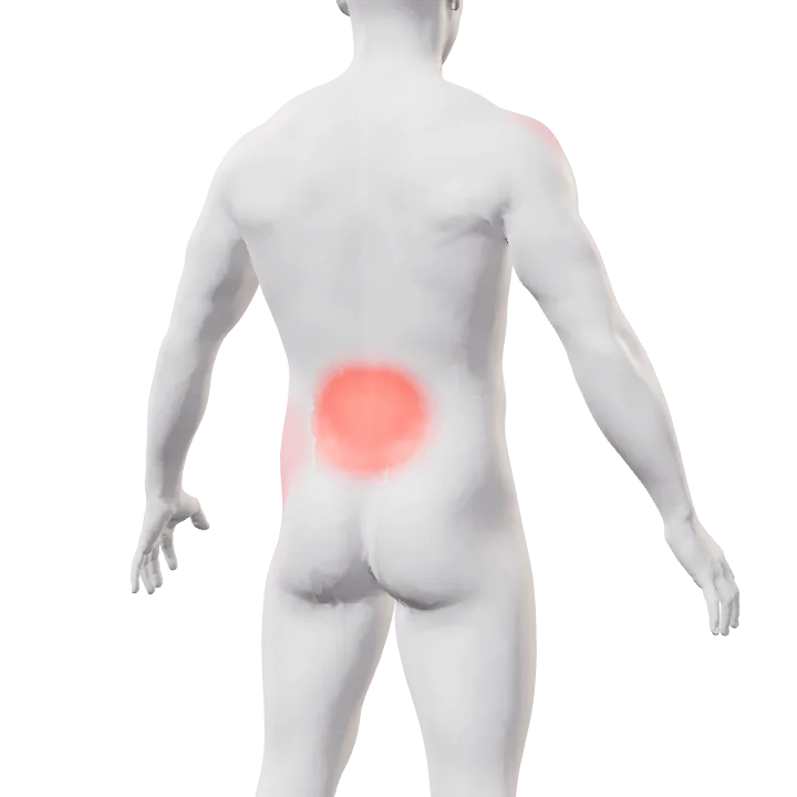 Espalda con la zona lumbar otra vez en rojo