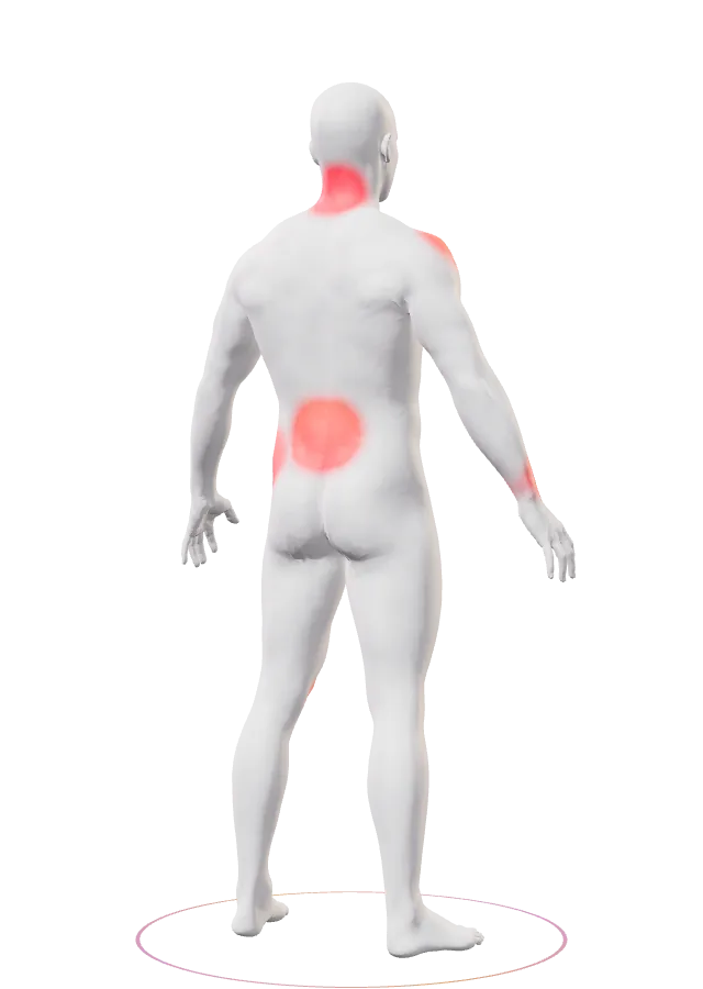 Cuerpo completo con todas las zonas de riesgo encendidas en rojo