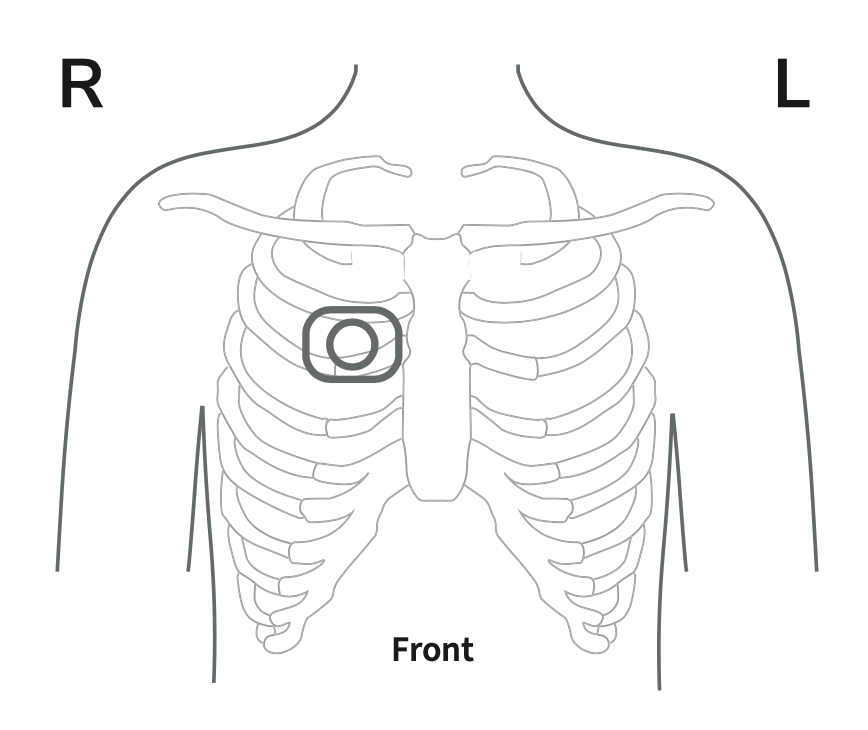 Mirrored view of human chest with marked location on upper right chest