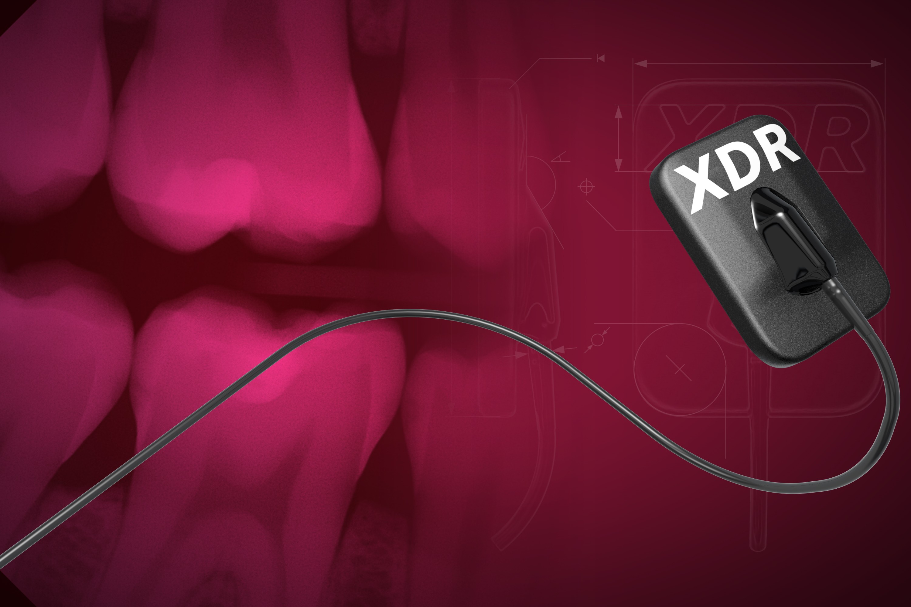 XDR Radiology
