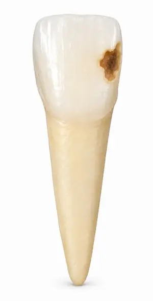 1 suprafață